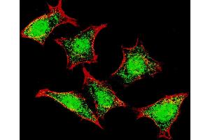 Fluorescent confocal image of HeLa cells stained with Natriuretic Peptide Receptor C (N-term) antibody. (NPR3 抗体  (N-Term))