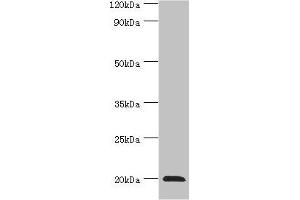 Western blot All lanes: Heat shock protein beta-2 antibody at 3 μg/mL + Mouse skeletal muscle tissue Secondary Goat polyclonal to rabbit IgG at 1/10000 dilution Predicted band size: 20 kDa Observed band size: 20 kDa (HSPB2 抗体  (AA 1-182))