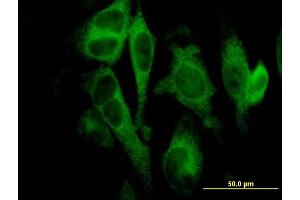 Immunofluorescence (IF) image for anti-Gasdermin D (GSDMD) (AA 1-484) antibody (ABIN566383)
