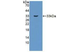 Figure. (HSD17B3 抗体  (AA 1-310))