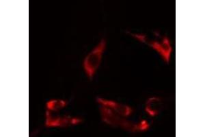 ABIN6275027 staining HuvEc cells by IF/ICC. (CEP95 抗体  (Internal Region))