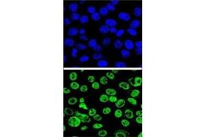 Confocal immunofluorescent analysis of MDM2 antibody with HeLa cells followed by Alexa Fluor 488-conjugated goat anti-rabbit lgG (green).