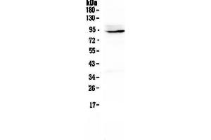 Western blot analysis of PTPN22 using anti-PTPN22 antibody . (PTPN22 抗体  (AA 1-309))
