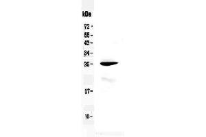 Western blot analysis of RND1 using anti-RND1 antibody . (RND1 抗体  (AA 105-229))