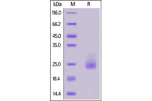 Human IL-31, His Tag on  under reducing (R) condition. (IL-31 Protein (AA 24-164) (His tag))