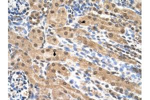 EIF3M antibody was used for immunohistochemistry at a concentration of 4-8 ug/ml to stain Epithelial cells of renal tubule (arrows) in Human Kidney. (Eukaryotic Translation Initiation Factor 3, Subunit M (EIF3M) (N-Term) 抗体)