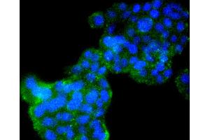 PC12 cells were stained with Cyclin B2 (2F4) Monoclonal Antibody  at [1:200] incubated overnight at 4C, followed by secondary antibody incubation, DAPI staining of the nuclei and detection. (Cyclin B2 抗体)