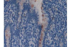 DAB staining on IHC-P; Samples: Rat Intestine Tissue (REG4 抗体  (AA 45-151))