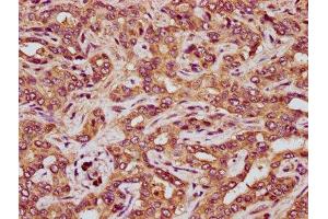 IHC image of ABIN7167744 diluted at 1:200 and staining in paraffin-embedded human liver tissue performed on a Leica BondTM system. (RCN3 抗体  (AA 71-161))