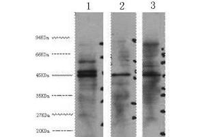 Western Blot analysis of 1) Hela, 2) Jurkat, 3) 293T cells using ENO2 Monoclonal Antibody at dilution of 1:3000. (ENO2/NSE 抗体)