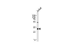 EXOSC2 Antibody (N-term) (ABIN1881328 and ABIN2843634) western blot analysis in Jurkat cell line lysates (35 μg/lane). (EXOSC2 抗体  (N-Term))