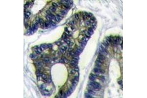 Image no. 3 for anti-Finkel-Biskis-Reilly Murine Sarcoma Virus (FBR-MuSV) Ubiquitously Expressed (FAU) (C-Term) antibody (ABIN357136) (FAU 抗体  (C-Term))