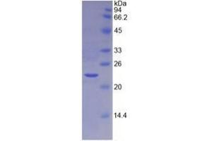 SDS-PAGE analysis of Mouse TIMP4 Protein. (TIMP4 蛋白)