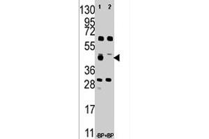 Western blot analysis of FDFT1 polyclonal antibody  in A-375 cell line lysate . (FDFT1 抗体  (Internal Region))