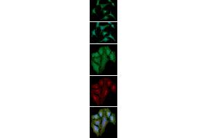 ICC/IF analysis of S100A4 in A549 cells line, stained with DAPI (Blue) for nucleus staining and monoclonal anti-human S100A4 antibody (1:100) with goat anti-mouse IgG-Alexa fluor 488 conjugate (Green). (s100a4 抗体  (AA 1-101))