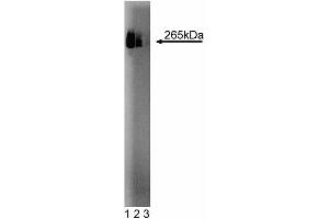 Western blot analysis of Fatty Acid Synthase on HepG2 cell lysate. (Fatty Acid Synthase 抗体  (AA 9-202))