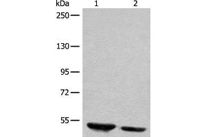 Western blot analysis of Human fetal brain tissue and mouse brain tissue lysates using DENND1B Polyclonal Antibody at dilution of 1:400 (DENND1B 抗体)