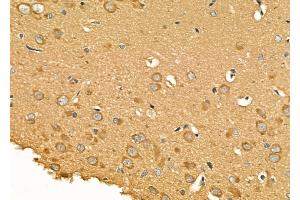 ABIN6260291 and ABIN6276897 at 1/100 staining Rat brain tissue by IHC-P.