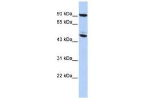 Image no. 1 for anti-Methyl CpG Binding Protein 2 (MECP2) (AA 35-84) antibody (ABIN6742304) (MECP2 抗体  (AA 35-84))