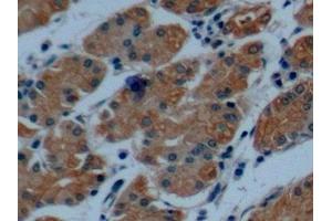 Detection of CK8 in Human Stomach Tissue using Polyclonal Antibody to Cytokeratin 8 (CK8)