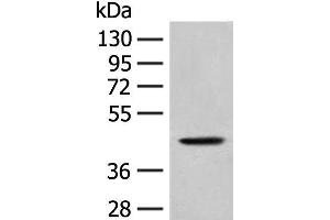 Western blot analysis of A549 cell lysate using HLA-B Polyclonal Antibody at dilution of 1:400 (HLA-B 抗体)