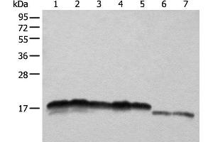 Western blot analysis of Hela HEPG2 A431 K562 and 231 cell Mouse liver tissue and Mouse brain tissue lysates using NDUFB11 Polyclonal Antibody at dilution of 1:1000 (NDUFB11 抗体)