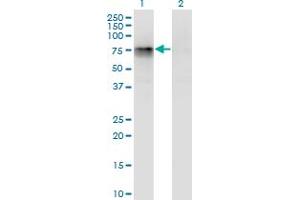 Western Blot analysis of CBFA2T2 expression in transfected 293T cell line by CBFA2T2 monoclonal antibody (M05), clone 3A2. (CBFA2T2 抗体  (AA 201-304))
