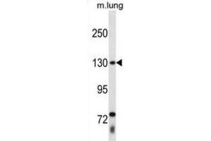 Western Blotting (WB) image for anti-Thyroid Hormone Receptor Associated Protein 3 (THRAP3) antibody (ABIN2998769) (THRAP3 抗体)
