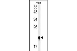 Western blot analysis of I Antibody (C-term)&65288,Cat(ABIN653856 and ABIN2843116)) in Hela cell line lysates (35 μg/lane). (IMP3 抗体  (C-Term))