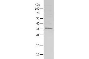 Melanoma Antigen Family F, 1 (MAGEF1) (AA 1-307) protein (His tag)