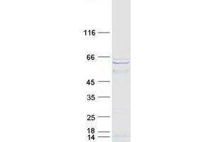 Validation with Western Blot