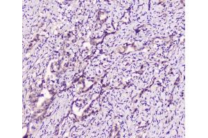 IHC analysis of LATS1 using anti-LATS1 antibody (ABIN6719580).