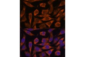 Immunofluorescence analysis of L929 cells using ME3 antibody (ABIN7268384) at dilution of 1:100.
