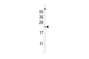 GAGE13 Antibody (N-term) (ABIN654525 and ABIN2844247) western blot analysis in K562 cell line lysates (35 μg/lane). (G Antigen 13 抗体  (N-Term))