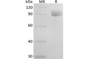 Western Blotting (WB) image for Interleukin 6 Receptor, alpha (IL6RA) protein (Fc Tag) (ABIN7319901)
