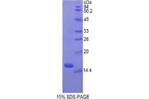 SDS-PAGE analysis of Rat Gastrokine 1 Protein. (Gastrokine 1 Protein (GKN1))