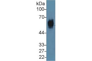 Detection of CK5 in Mouse Skin lysate using Polyclonal Antibody to Cytokeratin 5 (CK5) (Cytokeratin 5 抗体  (AA 163-471))