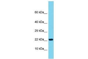 Host: Rabbit Target Name: SAPCD1 Sample Type: Fetal Kidney lysates Antibody Dilution: 1. (SAPCD1 抗体  (C-Term))