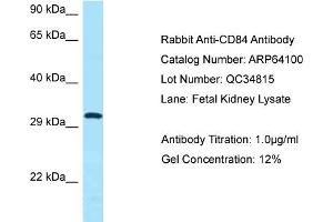 Western Blotting (WB) image for anti-CD84 (CD84) (C-Term) antibody (ABIN2789730) (CD84 抗体  (C-Term))