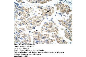 Rabbit Anti-HNRPK Antibody  Paraffin Embedded Tissue: Human Skeletal Muscle Cellular Data: Skeletal muscle  Antibody Concentration: 4. (HNRNPK 抗体  (C-Term))