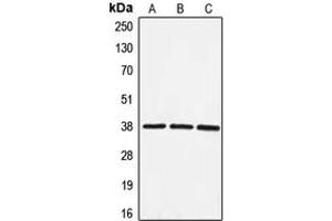 Western blot analysis of EIF3F expression in HeLa (A), HepG2 (B), NIH3T3 (C) whole cell lysates. (EIF3F 抗体  (Center))
