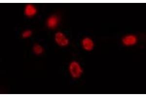 ABIN6274426 staining HepG2 cells by IF/ICC. (SPIC 抗体  (Internal Region))