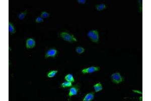 Immunofluorescent analysis of U251 cells using ABIN7163544 at dilution of 1:100 and Alexa Fluor 488-congugated AffiniPure Goat Anti-Rabbit IgG(H+L) (PLGRKT 抗体  (AA 1-147))