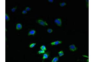 Immunofluorescent analysis of U251 cells using ABIN7163544 at dilution of 1:100 and Alexa Fluor 488-congugated AffiniPure Goat Anti-Rabbit IgG(H+L)