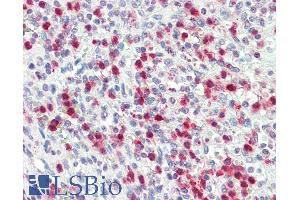 Immunohistochemistry (IHC) image for anti-Proteinase 3 (PRTN3) (AA 88-98) antibody (ABIN1781866)