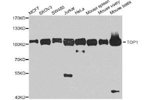 Western blot analysis of extracts of various cell lines, using TOP1 antibody. (Topoisomerase I 抗体)