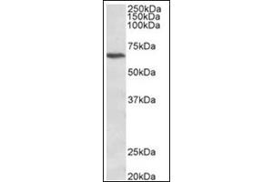 Staining of Jurkat lysate (35µg protein in RIPA buffer) using CACNB2 antibody at 1 µg/ml. (CACNB2 抗体  (C-Term))