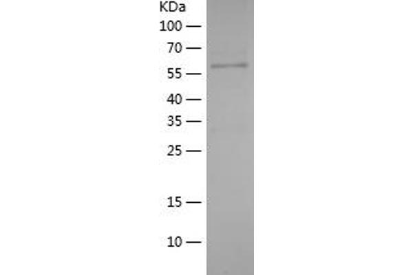 ABCF2 Protein (AA 1-218) (His-IF2DI Tag)