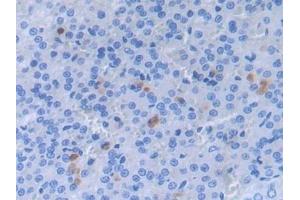 Detection of a2PI in Rat Adrenal gland Tissue using Polyclonal Antibody to Alpha 2-Antiplasmin (a2PI) (a2PI (AA 348-491) 抗体)