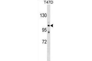 Western Blotting (WB) image for anti-ATPase, Ca++ Transporting, Type 2C, Member 1 (ATP2C1) antibody (ABIN2999252) (ATP2C1 抗体)